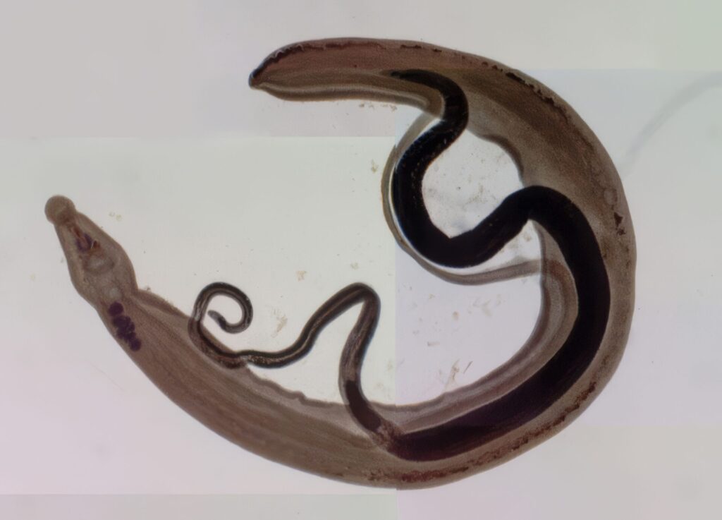 最凶寄生虫ランキング 第7位 日本住血吸虫