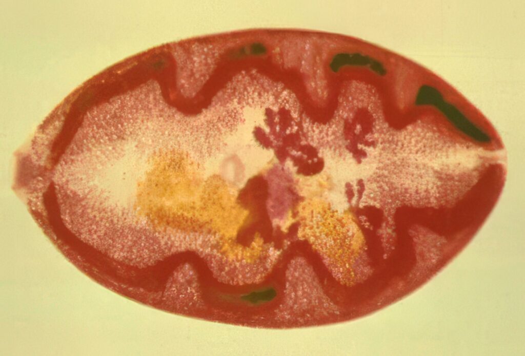 最凶寄生虫ランキング 第17位 ウェステルマン肺吸虫