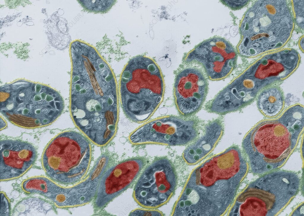 最凶寄生虫ランキング 第10位 トキソプラズマ